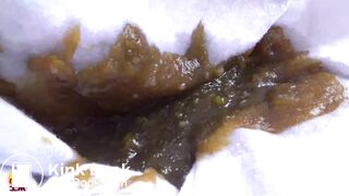 Asian diahrrea in the stairs