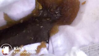 Asian diahrrea in the stairs