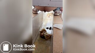 Chinese girl with diarrhea after eating barbecue