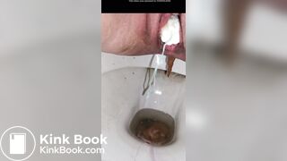 Girl with sloppy poop