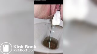 Girl with sloppy poop