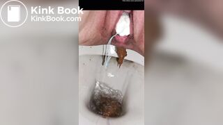 Girl with sloppy poop