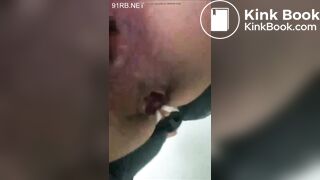 Hospital voyeur