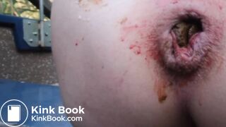 Fucking nasty scat girl 2