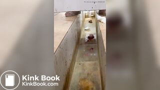 Chinese girl with large amount of diarrhea