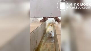 Chinese girl with large amount of diarrhea