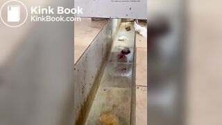 Chinese girl with large amount of diarrhea