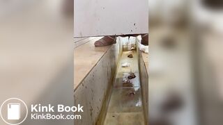 Chinese girl with large amount of diarrhea