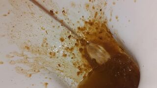 Girl diarrhea - video 8