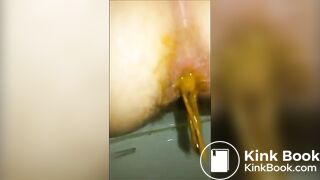 Woman unleashes diarrhea