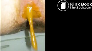 Woman unleashes diarrhea