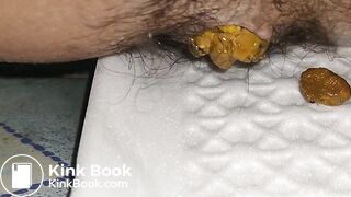 2 day poop - video 5