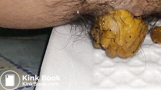 2 day poop - video 5
