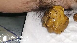 2 day poop - video 5