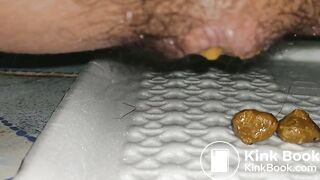 2 day poop - video 5