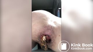 Prolapse 1 - video 5