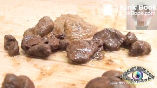 ****-256 悪質婦人科医院アナル痴漢