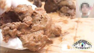 ****-256 悪質婦人科医院アナル痴漢