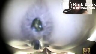 便秘女1
