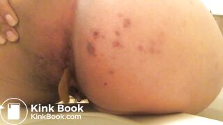 Shitting from the Ass