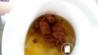 German poop