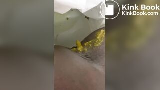 Ebony toilet diarrhea