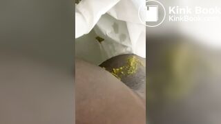 Ebony toilet diarrhea