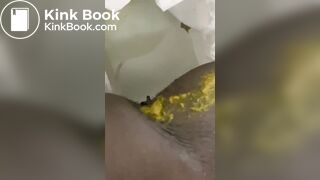 Ebony toilet diarrhea