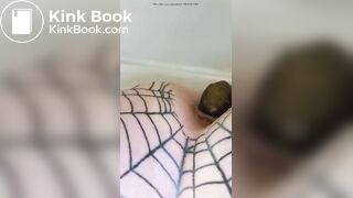 Spider poop