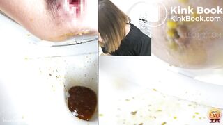 women has a liquid diarrhea