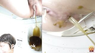 women has a liquid diarrhea