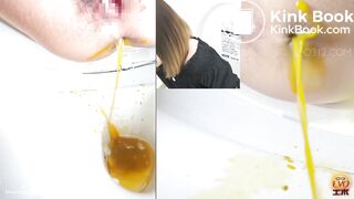 women has a liquid diarrhea