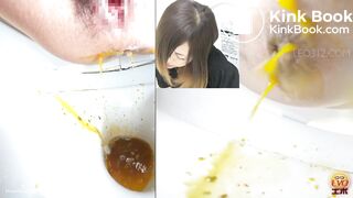 women has a liquid diarrhea