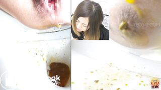 women has a liquid diarrhea