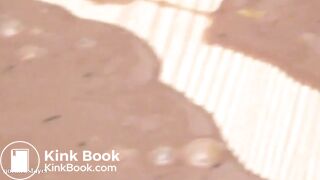 diarrhea liquid shit everywhere