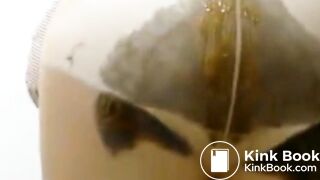 Pantyhose diarrhea (Super complitation)