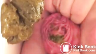 Prolapse Pro (Closeup)