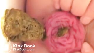 Prolapse Pro (Closeup)