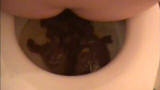 Farty Diarrhea 2 Times