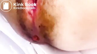 korean scat 한국인 스캇 - video 4