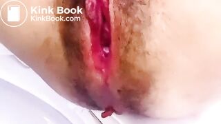 korean scat 한국인 스캇 - video 4