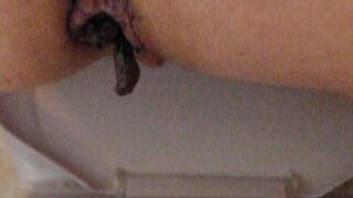 My butthole giving birth to poo