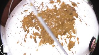Insane big Diarrhea All Over