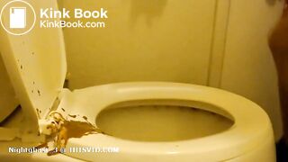 Laxative induced diarrhea