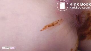 Girl Pooping - video 70