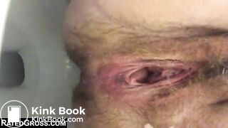 Woman with a hairy pussy pooping in the toilet