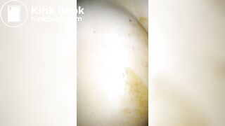 Amateur gf scat fisting