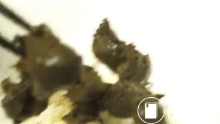 C*U*N-001] Post Feces Diary Post Scat