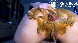 Anal prolapse after fisting her ass