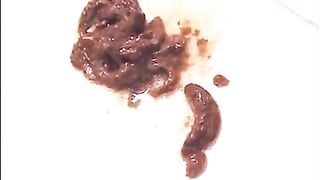 ...-36 Enema Defecation 4 Hours SPECIAL